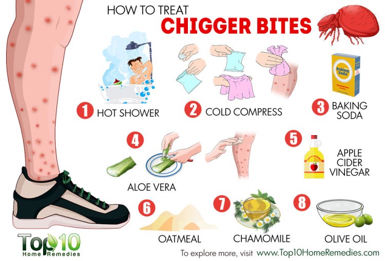 chigger-bites